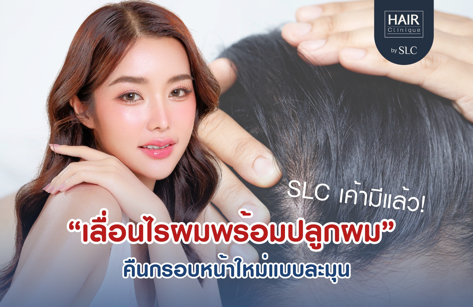 เลื่อนไรผมพร้อมปลูกผม , ลดขนาดหน้าผาก, หน้าผากกว้าง, ปลูกผมปรับกรอบหน้า