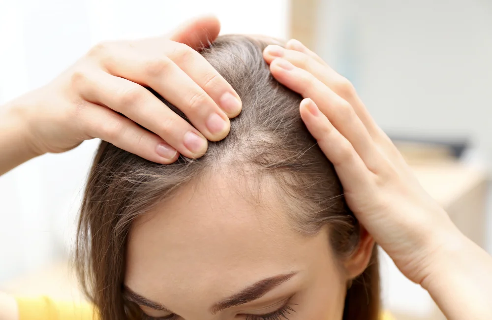 ผมร่วงเกิดจากสาเหตุอะไร