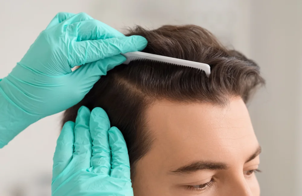 วิธีรักษาผมร่วง